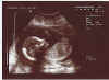 13th scan of Connall