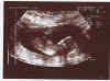 1st scan of Connall