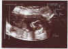 3rd scan of Connall